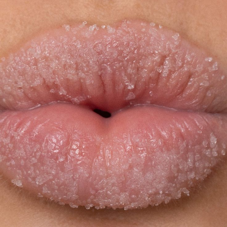 Lip Health 101: From Crusty to Cushy